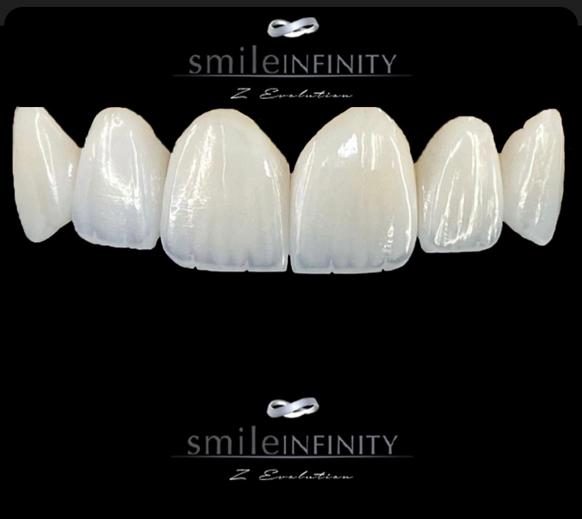 Hollywood Smile Lebanon — ZEvolution Veneers ceramic shells by Smile Infinity®, Dr. Habib Zarifeh